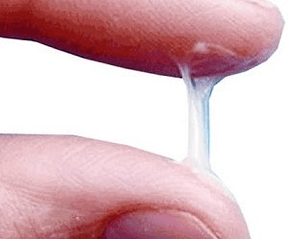 Wie sieht der Ausfluss eines Mannes normalerweise aus